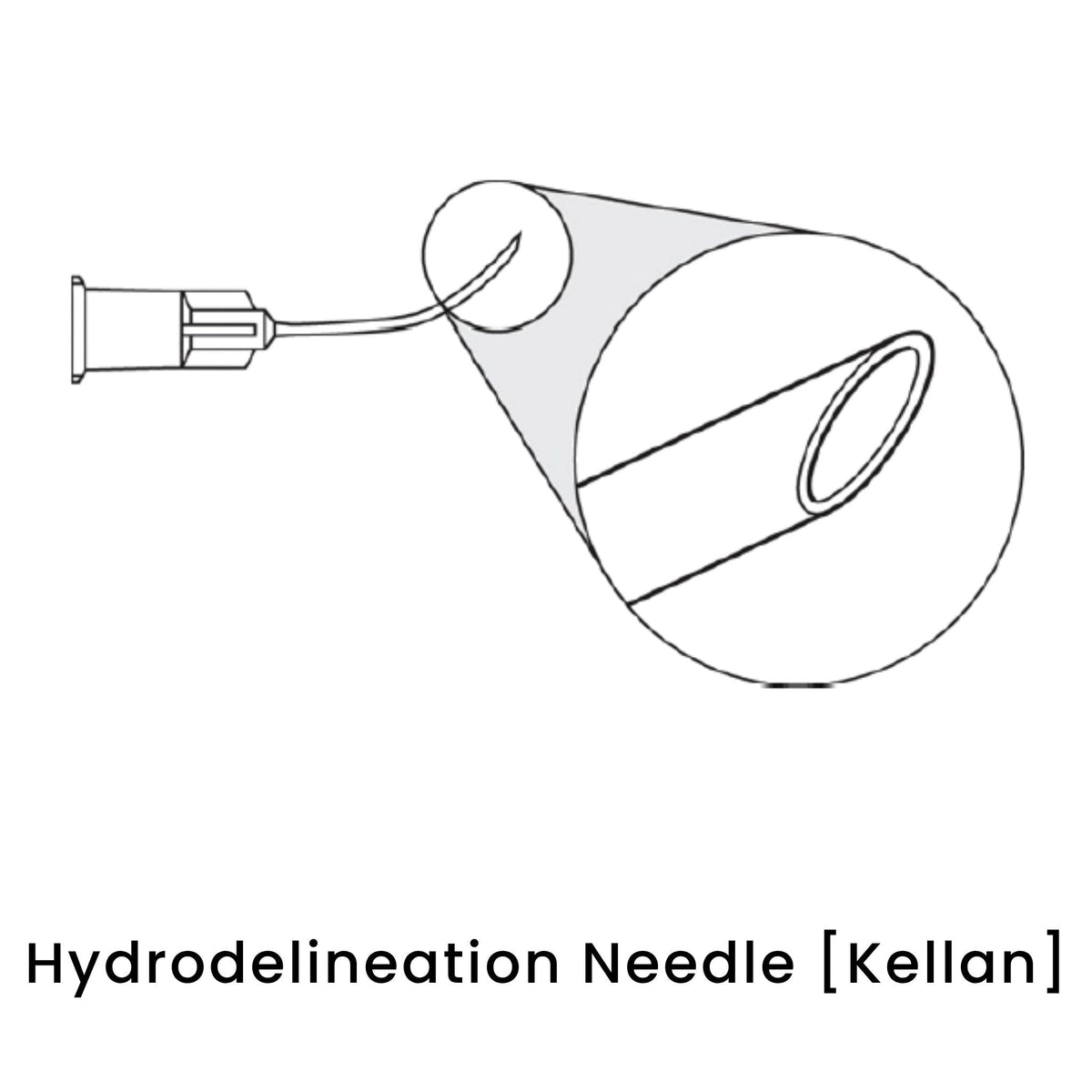 view of anodyne hydrodelineation needle kellan 1