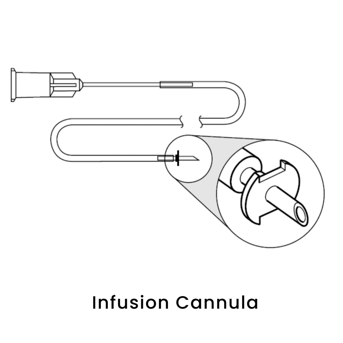 view of anodyne infusion cannula