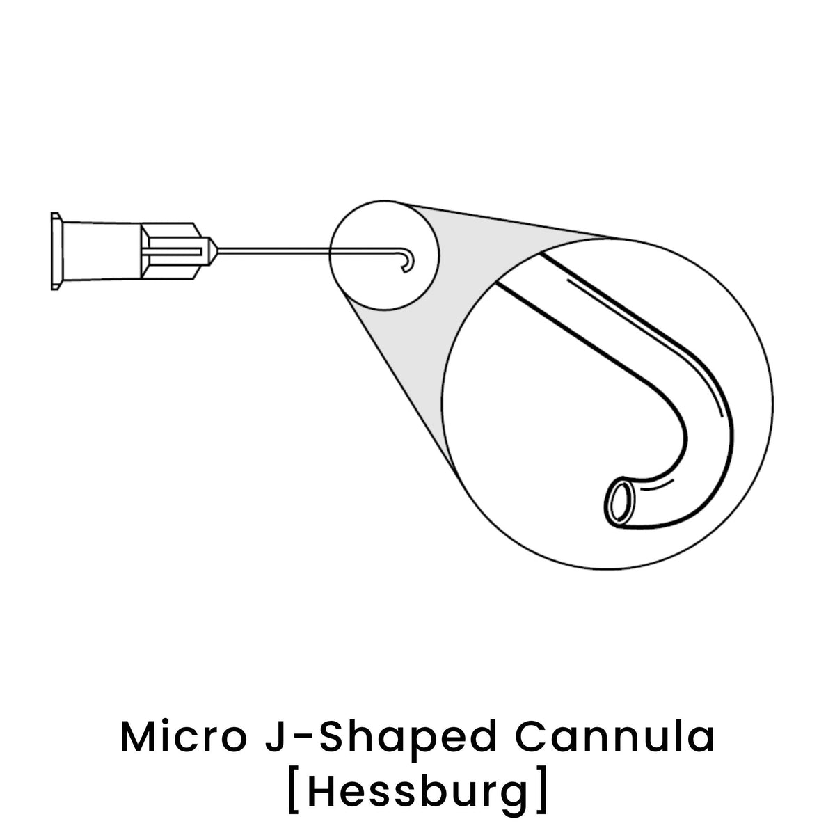 view of anodyne micro j shaped cannula hessburg