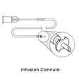 view of anodyne infusion cannula