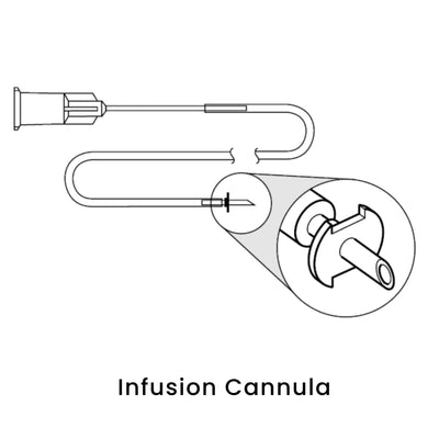 view of anodyne infusion cannula