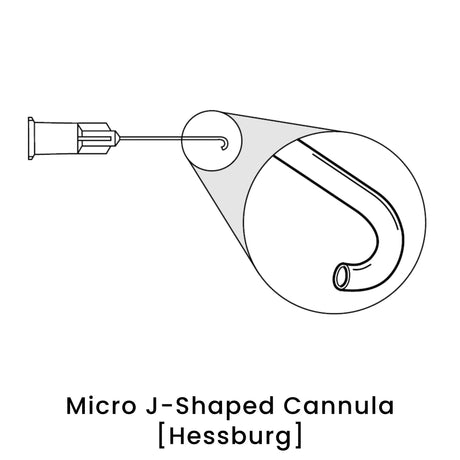 view of anodyne micro j shaped cannula hessburg