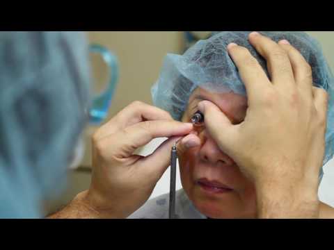 More On The Davis MD OneStep